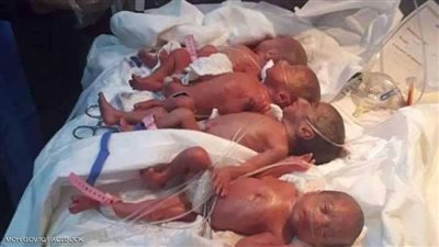 فرحة لم تكتمل.. وفاة 6 توائم بعد أيام من ولادتهم