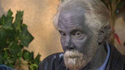 أبرزها الإيماء.. 5 أمراض ما زالت مجهولة لدى الأطباء