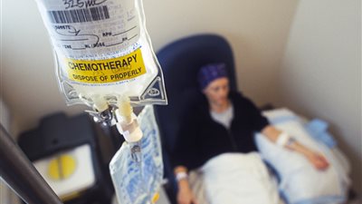 أستاذ أورام: العلاج الكيماوي سيختفي خلال عامين لهذا السبب