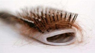 7 نصائح فعالة تنهي مشكلة تساقط الشعر للجنسين