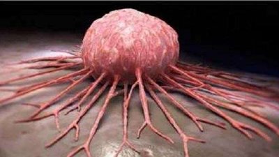 اختراق علمي يعالج  10 أنواع من السرطان