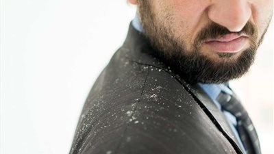 انتبه .. قشرة الرأس قد ترتبط بمرض خطير