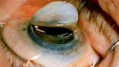 برلمانية تتقدم بـ«إحاطة» ضد نزع قرانية المتوفي دون موافقته