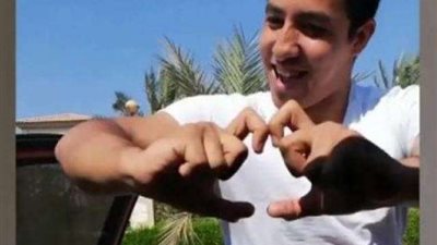 بعد رقصته بالعكاز.. ”عبد العظيم” يتحدى ”كيكي” بقدم واحدة (فيديو)