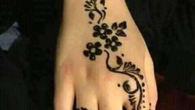 رسم «الحنة» بالأكسجين والحجر الأسود يسبب حساسية في الجلد