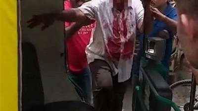 رجل يفقأ عين والده طمعًا في الميراث.. (صور)