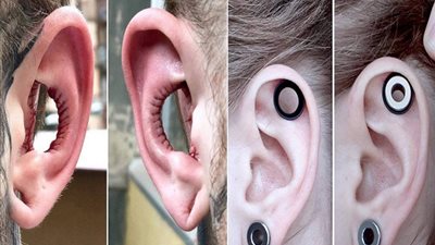 آخر التقاليع.. استئصال جزء من الأذن موضة تجتاح العالم