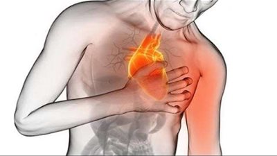 استشاري أوعية دموية: السجائر المتسبب الوحيد بجلطات القلب