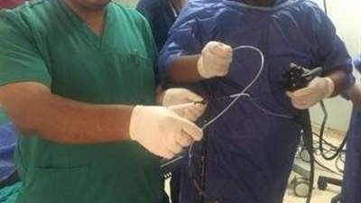 بدء العمل بوحدة جراحات مناظير الجهاز الهضمي بمستشفي الأقصر الدولي