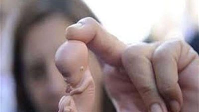 تعرفي على سبب الإجهاض المتكرر