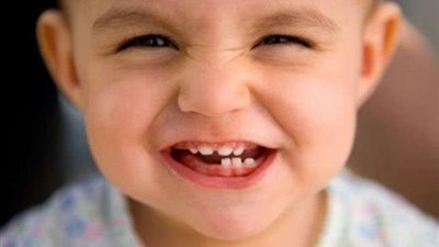 تعرفي على أبرز مشاكل الأسنان التي يتعرض لها طفلك