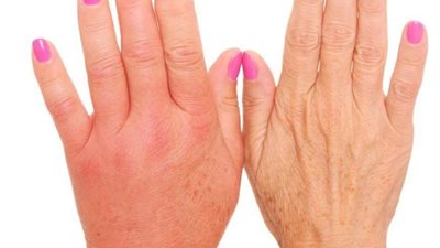 علاج الاملاح الزائدة فى الجسم بطرق بسيطة