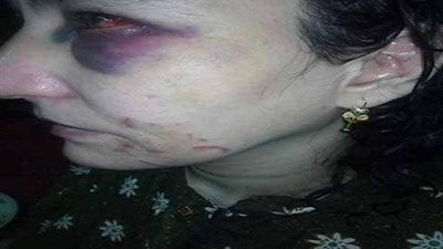 بالصور.. بسبب المثيرات أخ يدمر خلايا مخ شقيقته