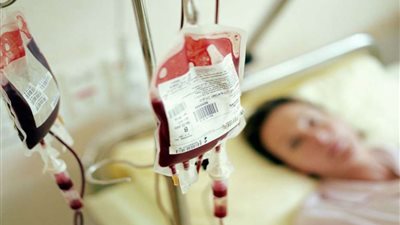 دراسة: أصحاب زمرة O  محميون من مرض الملاريا