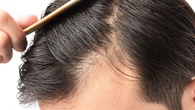 لاستعادة مظهرك وأناقتك.. 6 أطعمة تحميك من تساقط الشعر