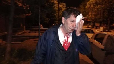 صحفي تركي يتعرض للضرب بعد انتقاده لقرار أردوغان بإلغاء الانتخابات