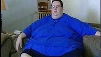 استشاري تجميل: 7 إرشادات ينبغي اتباعها بعد عمليات شفط الدهون