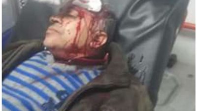 إصابة شخص إثر حادث تصادم بالحوامدية