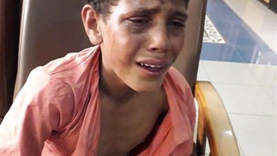 إنقاذ طفل من الموت بسبب شدة الجوع والمرض ببورسعيد