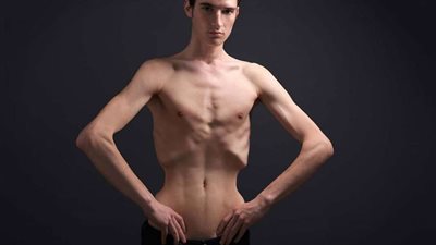 9 نصائح لزيادة الوزن في الصيف