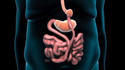 استشارى سمنة يكشف عن الفئات المستهدفة لعملية تحويل المسار