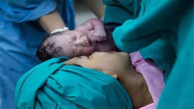 الطبيعي يكسب.. الولادة القيصرية تسبب 7 مخاطر كارثية