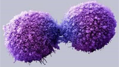 فى يومه العالمي.. تعرف على أشهر الأطعمة لمكافحة السرطان