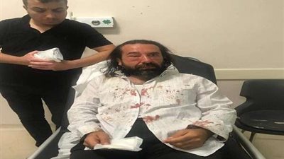 أنصار إردوغان يعتدوا بالضرب على أحد داعمي مرشح المعارضة