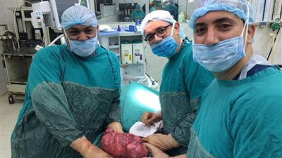 استئصال ورم يزن 40 كيلو من سيدة بطنطا