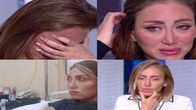 بعد مرض ريهام سعيد.. 5 طرق لكيفية علاج بكتيريا الجلد