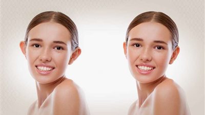 استشاري تجميل يكشف السن المناسبة لعمليات تجميل الأذن