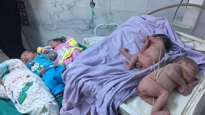 صحة القليوبية: لجنة عاجلة تحقق في واقعة بتر العضو الذكري لطفل