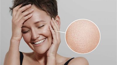 للبشرة الدهنية.. 3 علاجات للتخلص من المسامات الواسعة