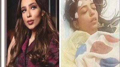 بعد وفاة صابرين بورشيد.. 6 أعراض صامتة لـ سرطان المخ