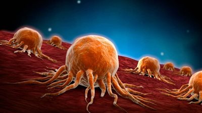 بهذه الحيلة.. احمي نفسك من سرطان الأمعاء