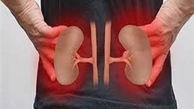 أبرزها النعاس والغثيان.. 8 أعراض للإصابة بالفشل الكلوي