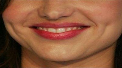 عيوب خلقية تقبلها الأشخاص فأصبحت من «سمات الجمال»