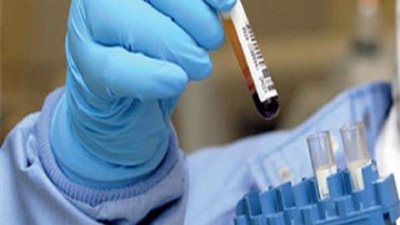 نقابة العلميين تطعن على حكم قصر العمل بالتحاليل الطبية على الأطباء