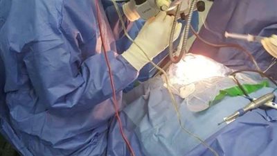 إجراء 6 عمليات زراعة قوقعة بمستشفى الهلال بسوهاج