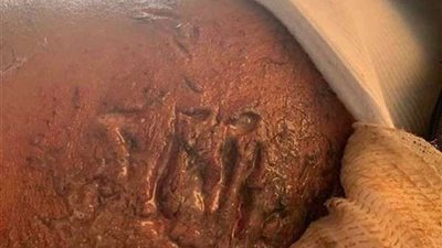 أول صورة لنجل أحمد شيبة بعد نجاته من حادث سير مروع