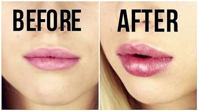 بدون عمليات تجميل.. خلطة طبيعية لنفخ الشفايف في البيت