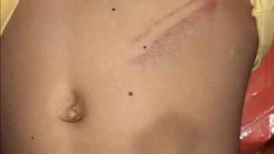 لجنة للكشف على الحالة النفسية للطفلة 