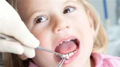 استشاري يوضح توقيت عملية زراعة الأسنان وأهميتها