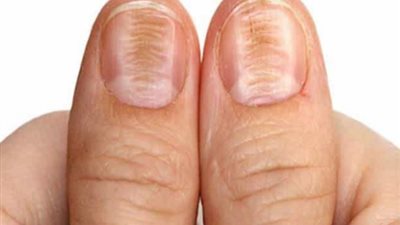 حيلة سحرية لأظافر قوية وناصعة البياض