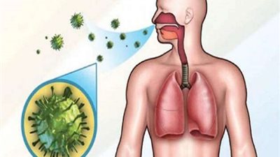 طبيب يوضح أعراض مرض السل