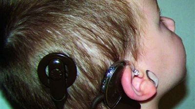 رئيس اتحاد الجمعيات الأهلية: نشارك بكثافة لتنفيذ مبادرة علاج ضعف السمع وحياة كريمة