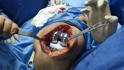 كلية الطب بمستشفى جامعة بني سويف.. صرح علمي يحوي تخصصات نادرة لخدمة شمال الصعيد