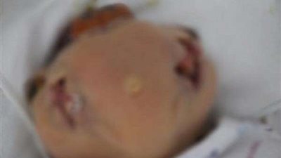 الأغرب في التاريخ.. ولادة طفل بـ