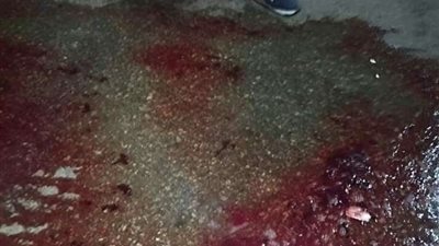 إصابة طفل بنزيف حاد في المخ بحادث دموي بدمياط