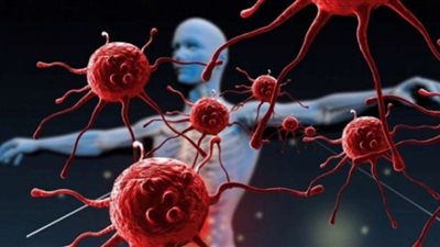 تعرف على أخطر أنواع السرطان بداية من الأربعينات